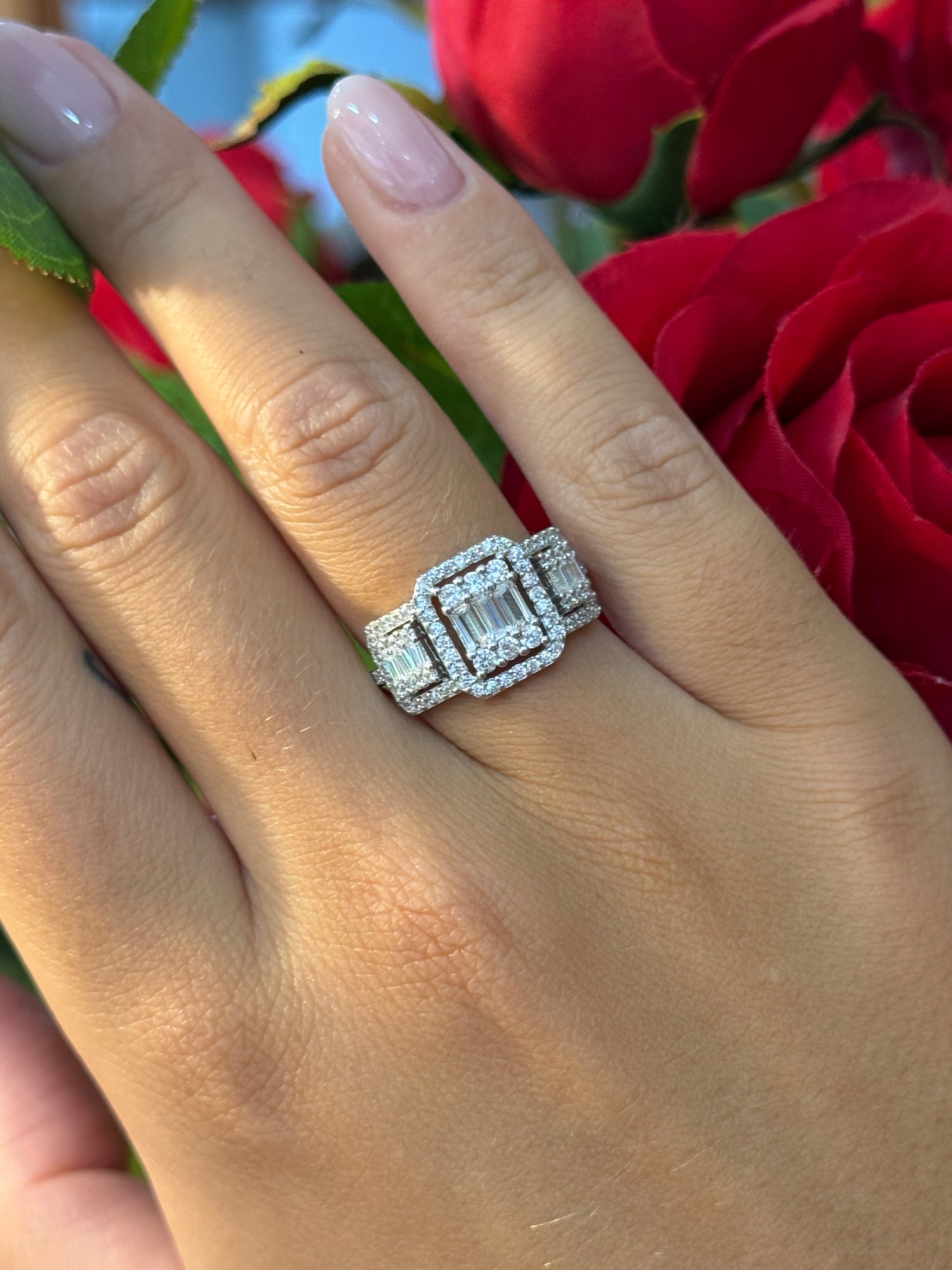 Anello Ely
